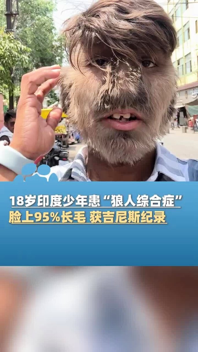 一一影院手机在线观看：高清流畅追剧神器，免费资源一键收藏（长尾关键词：手机免费追剧平台、高清影视在线观看、最新热门影视资源）